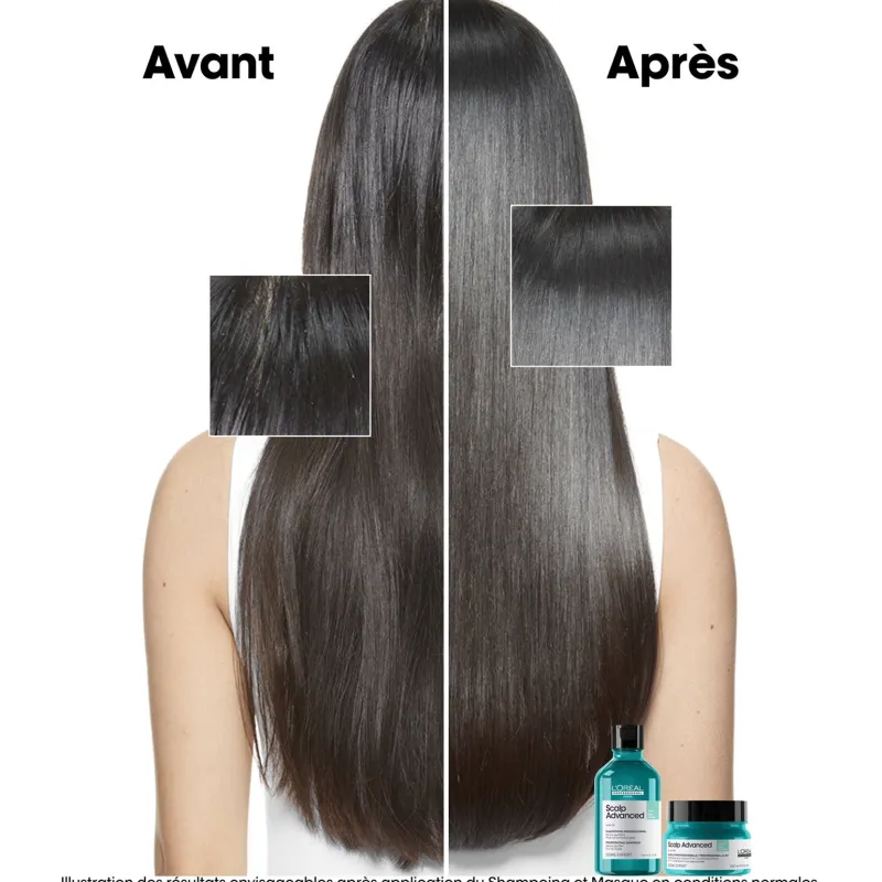L’Oréal Professionnel Paris Argile 2-en-1 purifiante anti-gras Scalp Advanced 250ml Sale