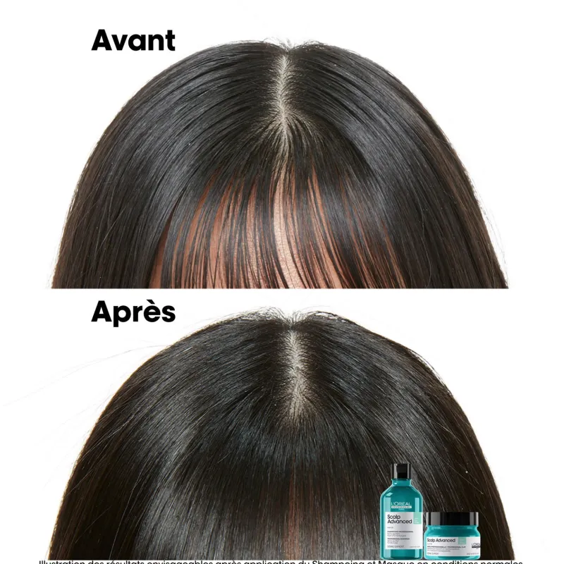 L’Oréal Professionnel Paris Argile 2-en-1 purifiante anti-gras Scalp Advanced 250ml Sale