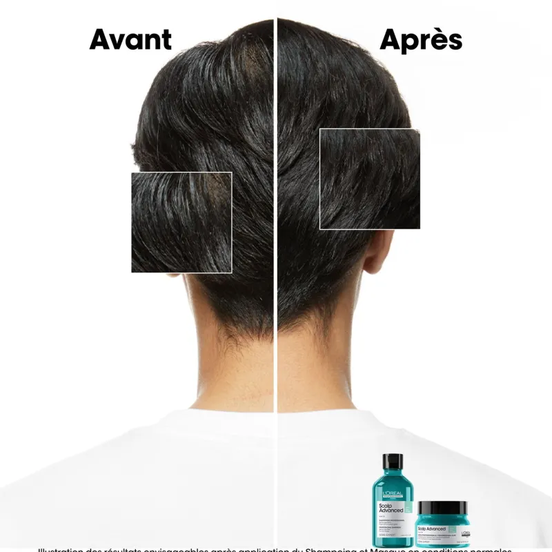 L’Oréal Professionnel Paris Argile 2-en-1 purifiante anti-gras Scalp Advanced 250ml Sale
