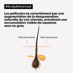 L’Oréal Professionnel Paris Routine anti-pellicules grasses Scalp Advanced New
