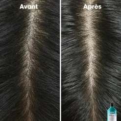 L’Oréal Professionnel Paris Shampooing dermo-clarifiant anti-pelliculaire Scalp Advanced 300ml Hot