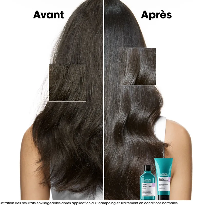 L’Oréal Professionnel Paris Shampooing dermo-régulateur anti-inconfort Scalp Advanced 1500ml Best